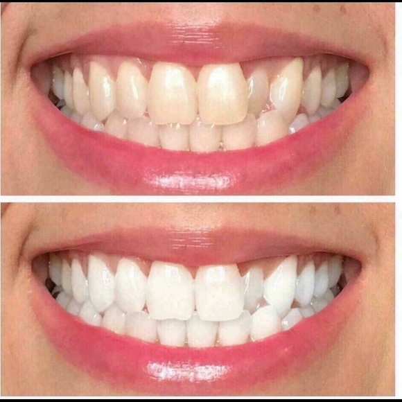 Toothpaste - Picture 7 of 7